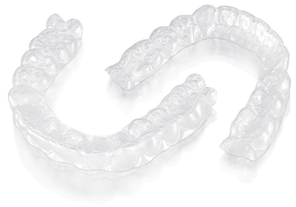 3m clarity aligners