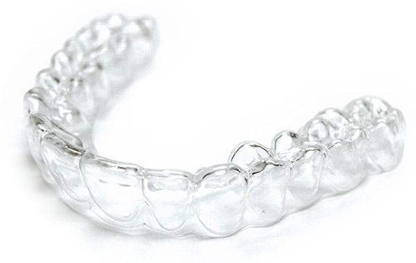 invisalign clear aligner